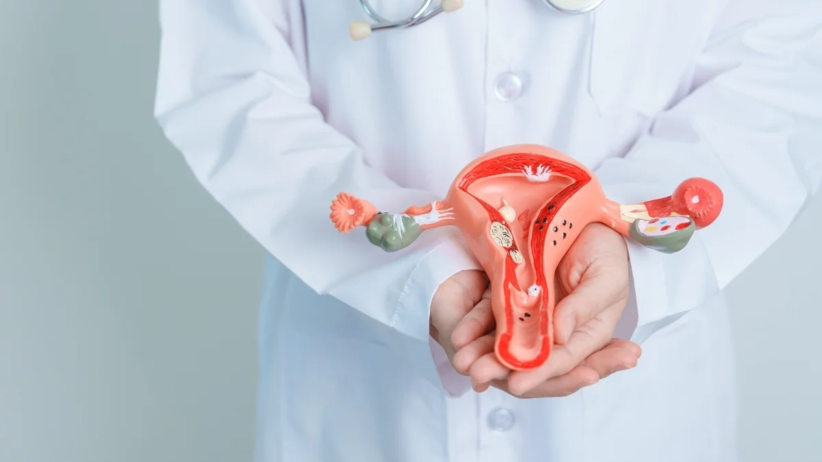 1 de cada 10 mujeres en edad reproductiva puede padecer endometriosis