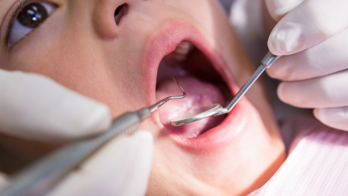 El 95% de los mexicanos padece enfermedades bucales - un reto para la salud pública