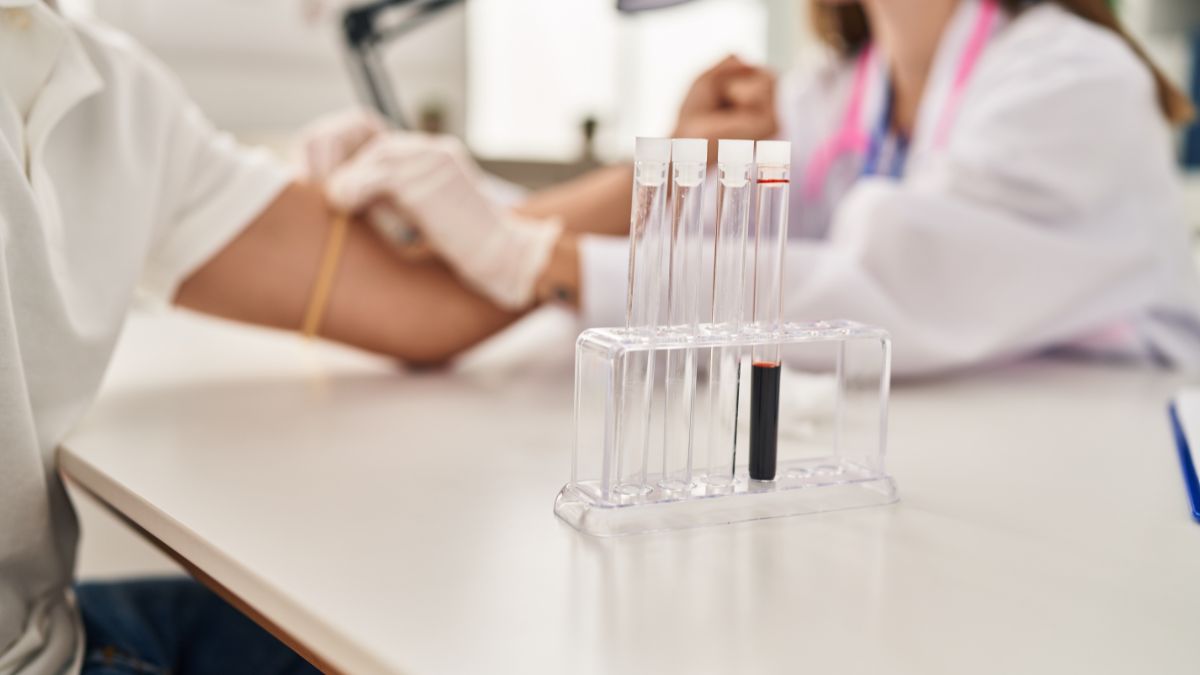 Una simple prueba de laboratorio podría predecir el deterioro cognitivo en pacientes con Alzheimer, según estudio