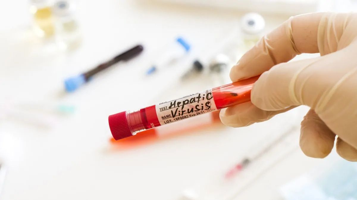 México avanza hacia la eliminación de la hepatitis C como problema de salud pública