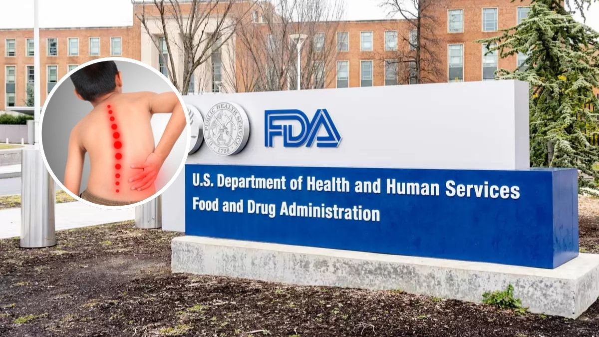 FDA aprueba nueva terapia génica para tratar la atrofia muscular espinal en adultos y niños mayores de 2 años