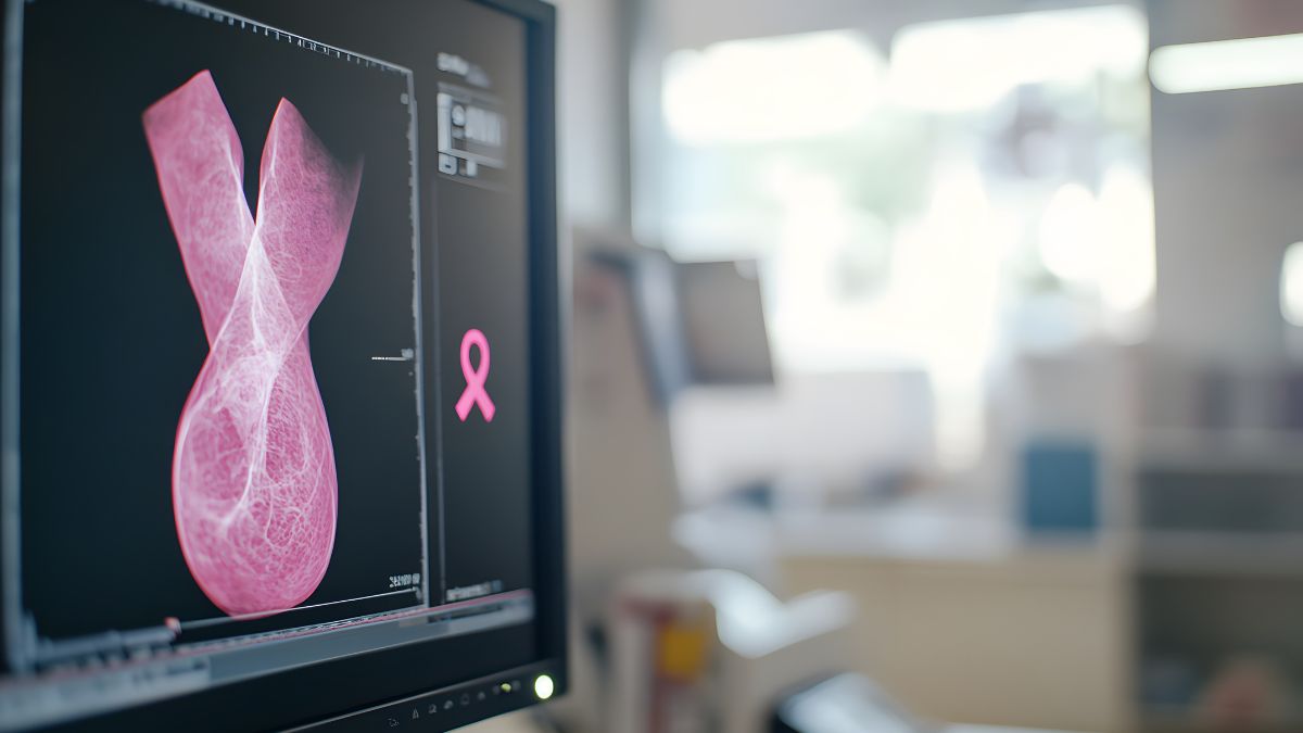 Cáncer de mama en México la cobertura de mastografía cayó tras la pandemia y sigu