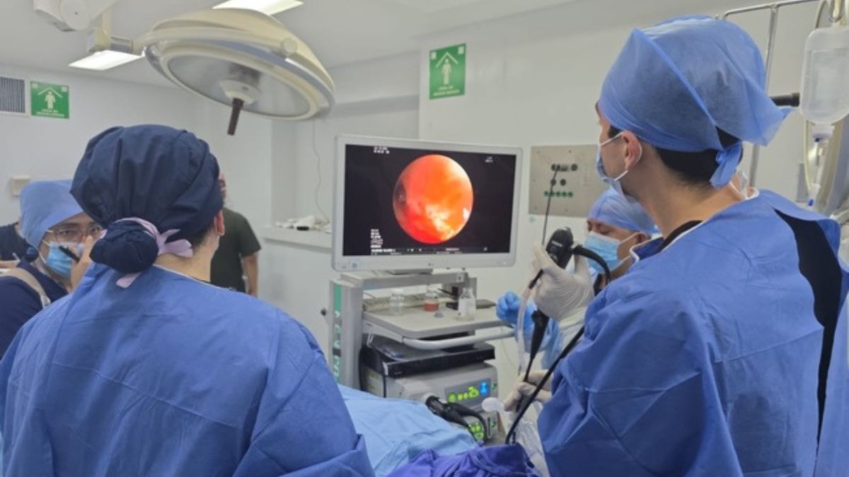ISSSTE impulsa broncoscopias para la detección oportuna de cáncer de pulmón en México