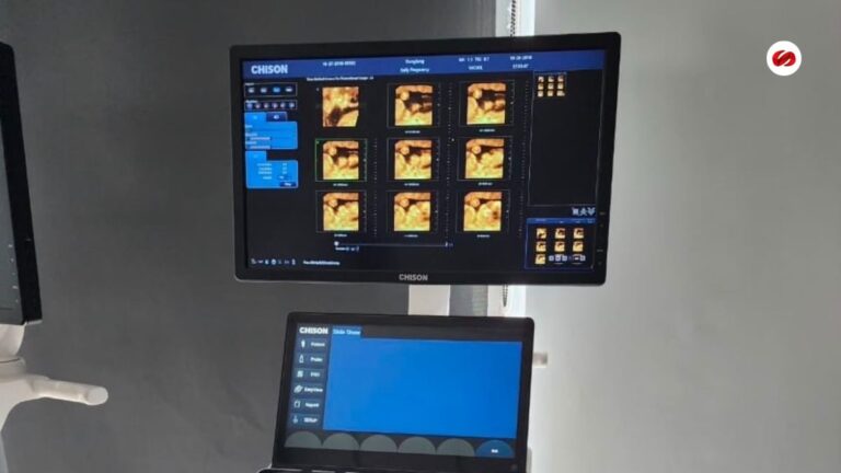 ISSSTE refuerza hospital de alta especialidad en Edomex entregan equipo médico para cardiología y urgencias