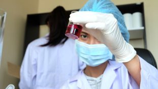 Avance en el diagnóstico del síndrome de fatiga crónica un análisis de sangre alcanza el 96% de exactitud