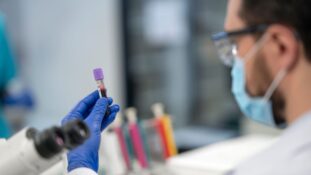 Banco de Piel del INR cumple 15 años con 260 implantes quirúrgicos en grandes quemaduras