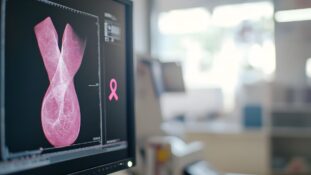 Cáncer de mama en México la cobertura de mastografía cayó tras la pandemia y sigu