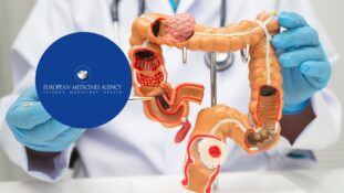 EMA recomienda tratamiento basado en inmunoterapia para el cáncer anal avanzado