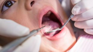 El 95% de los mexicanos padece enfermedades bucales - un reto para la salud pública