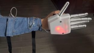 IMSS Bienestar desarrolla prótesis electromecánica de mano con impresión 3D