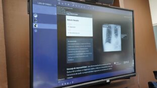 INER integra IA para fortalecer la detección temprana de cáncer de pulmón en México