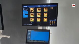 ISSSTE refuerza hospital de alta especialidad en Edomex entregan equipo médico para cardiología y urgencias