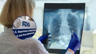 La FDA aprueba medicamento para fibrosis pulmonar progresiva en adultos