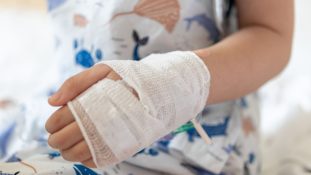 Más de 11 mil niños sufren quemaduras cada año en México estudio advierte que la mayoría son menores de cinco años y urge prevención nacional
