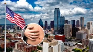 Texas declara oficialmente el fin del brote de sarampión tras afectar a 762 personas y provocar dos muertes infantiles