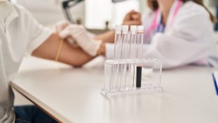 Una simple prueba de laboratorio podría predecir el deterioro cognitivo en pacientes con Alzheimer, según estudio