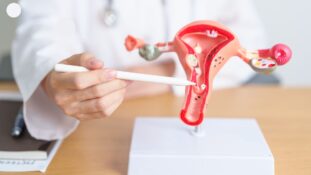 VPH y cáncer de cuello uterino en México- epidemiología, prevención y brechas que persisten
